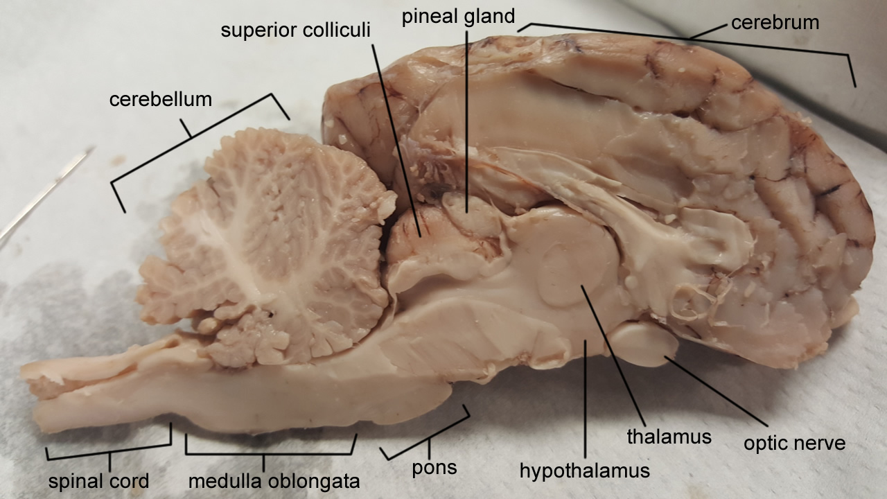Sheep brain in sagittal section.