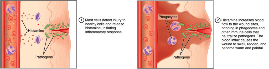 The top panel of this figure shows the mast cells detecting an injury and initiating an inflammatory response. The bottom panel shows the increase in blood flow in response to histamine, which brings in phagocytes and other immune cells that neutralize pathogens. The blood influx causes the wound to swell, redden, and become warm and painful.