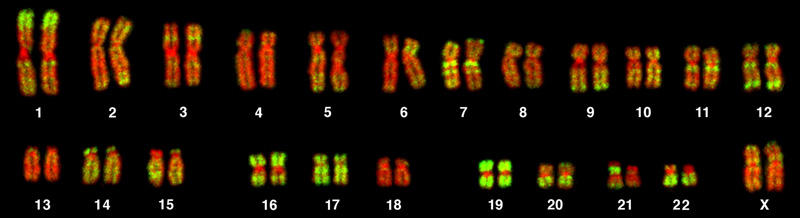 This is a karyotype of a human female. There are 22 homologous pairs of chromosomes and an X chromosome.