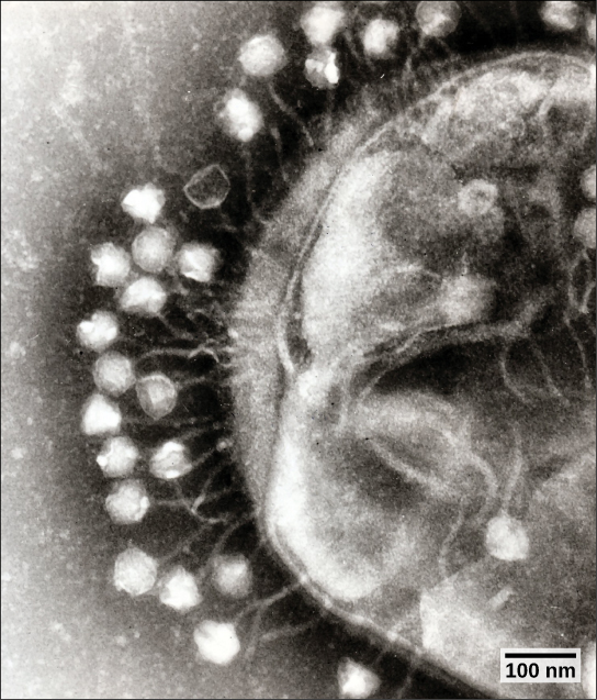 The micrograph shows hexagonal bacteriophage capsids attached to a host bacterial cell by slender stalks.