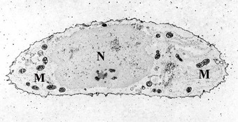 This is a microscopic photo of a slide of chondrocyte, stained for calcium, showing its nucleus (labeled N) and mitochondria (labeled M).