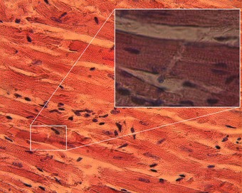 This is a detailed, closeup photo of an intercalated disk in a heart muscle contains gap junctions. Intercalated disks consist of three different types of cell–cell junctions: actin filaments anchoring adherens junctions, intermediate filaments anchoring desmosomes, and gap junctions. Gap junctions are responsible for electrochemical and metabolic coupling.