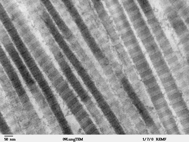 This is a black and white x-ray of collagen fibers, the strongest and most abundant of all the connective tissue fibers.