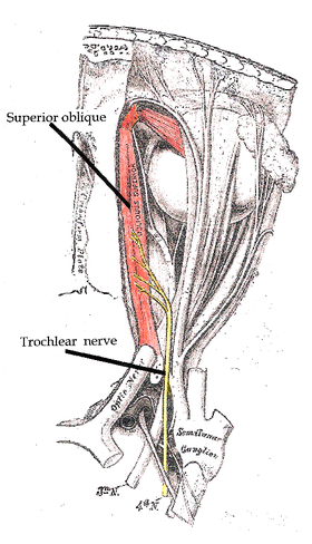 This is a drawing of the trocheal nerve that shows where it innervates the superior oblique muscle.