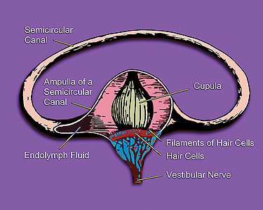 This is an illustration of the inner ear that shows its semicircular canal, hair cells, ampulla, cupula, vestibular nerve, and fluid.