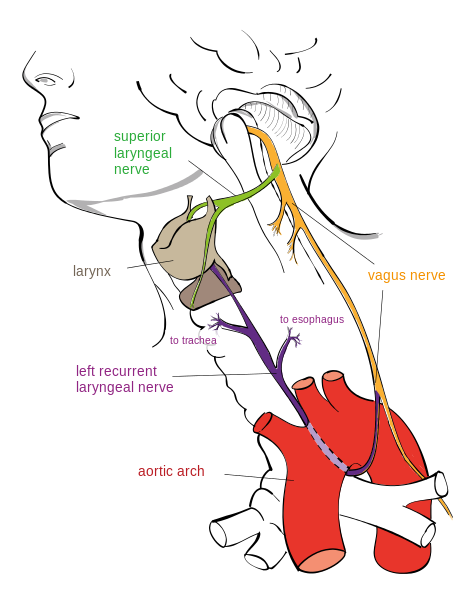 This is a drawing of a human head and neck. The vagus nerve is seen running from the medulla to the chest.