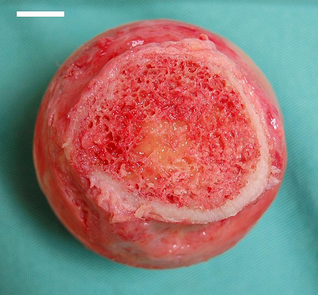 This is a closeup, cross-section photo of the head of a femur. The head of the femur shows lamellar bone on its borders and trabecular bone in its center.