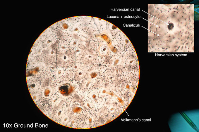 This is a photo taken through a microscope that shows the anatomy of compact bone with a detailed view of an osteon. The Haversian system is called out in the osteon: The Haversian canal, lacuna and osteocype, and the canaliculi are identified.