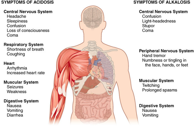This is a cutaway view showing the symptoms of acidosis and alkalosis on various body systems. The systems affected by acidosis are: the central nervous system, with symptoms of headache, sleepiness, confusion, loss of consciousness, and coma. Respiratory system symptoms include shortness of breath and coughing. Heart symptoms include arrhythmia and increased heart rate. Muscular system symptoms include seizures and weakness. Digestive system symptoms are nausea, vomiting, or diarrhea. The systems affected by alkalosis are: the central nervous system, with symptoms of confusion, light-headedness, stupor, and coma. Peripheral nervous system symptoms include hand tremor and numbness or tingling in the face, hands, or feet. Muscular system symptoms include twitching and prolonged spasms. Digestive system symptoms are nausea and vomiting.