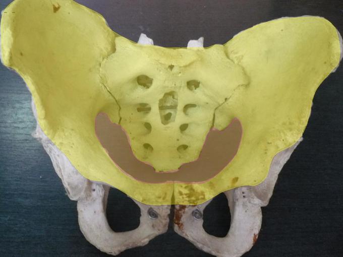 This is a photo of the greater and lesser pelvis The greater pelvis is highlighted in yellow and is larger and superior to the lesser pelvis (highlighted in red) where the pelvic inlet is located.