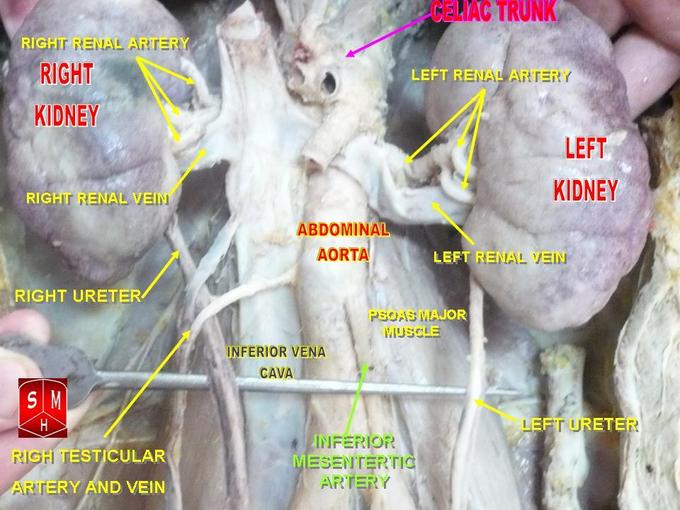 This is a photograph of the kidneys and their surroundings. The renal arteries are seen to branch off of the abdominal aorta and supply the kidneys with blood.