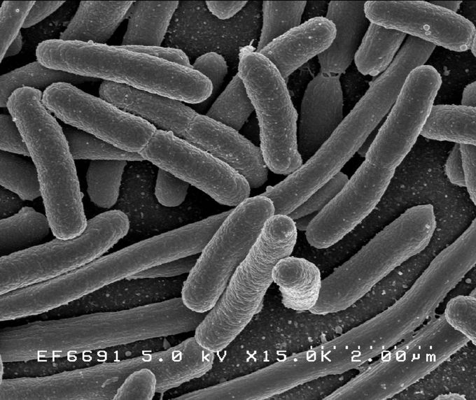 This is a photograph of Escherichia coli, one of the many species of bacteria present in the human gut.