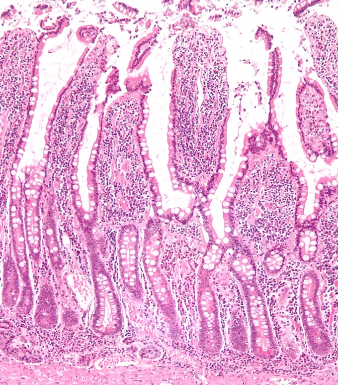 This is a low-magnification micrograph of small intestinal mucosa that shows villi.