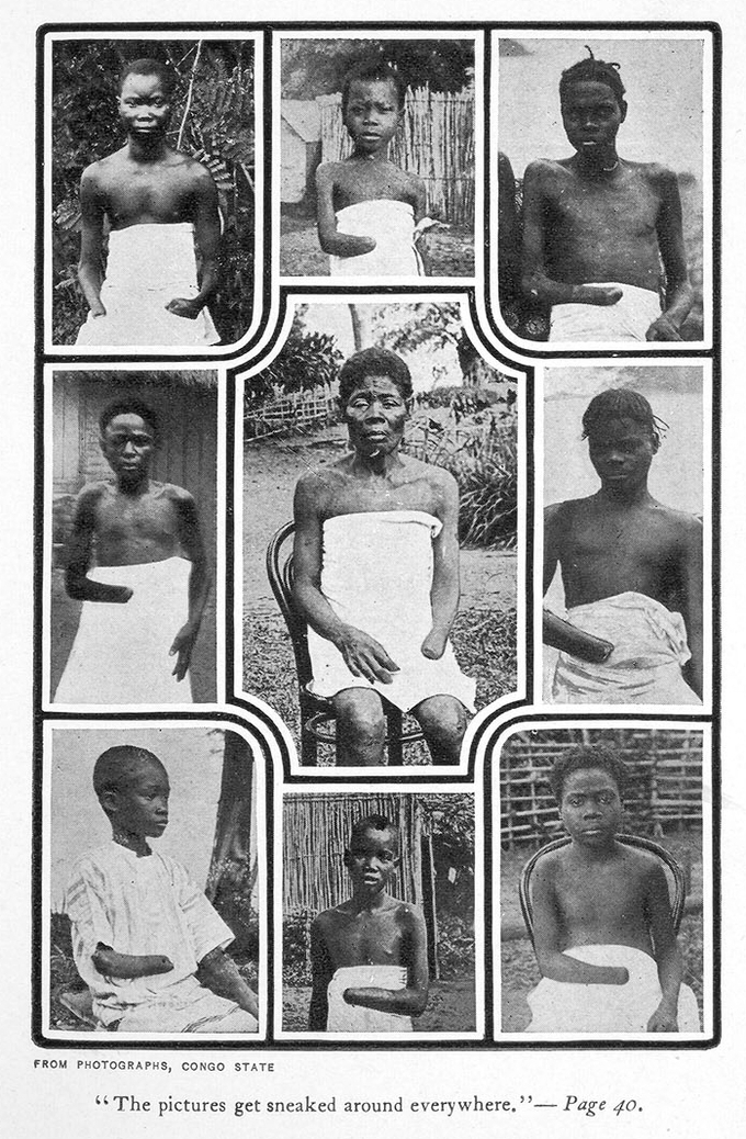 Images of Congolese people, including children, with one of their hands cut off, a punishment typical during Leopold II's reign over the Congo.