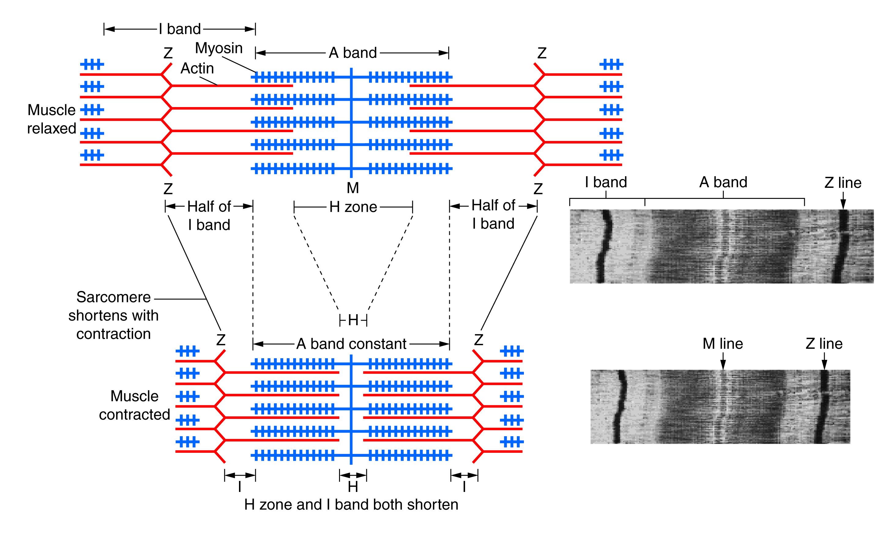 sarcomere contraction