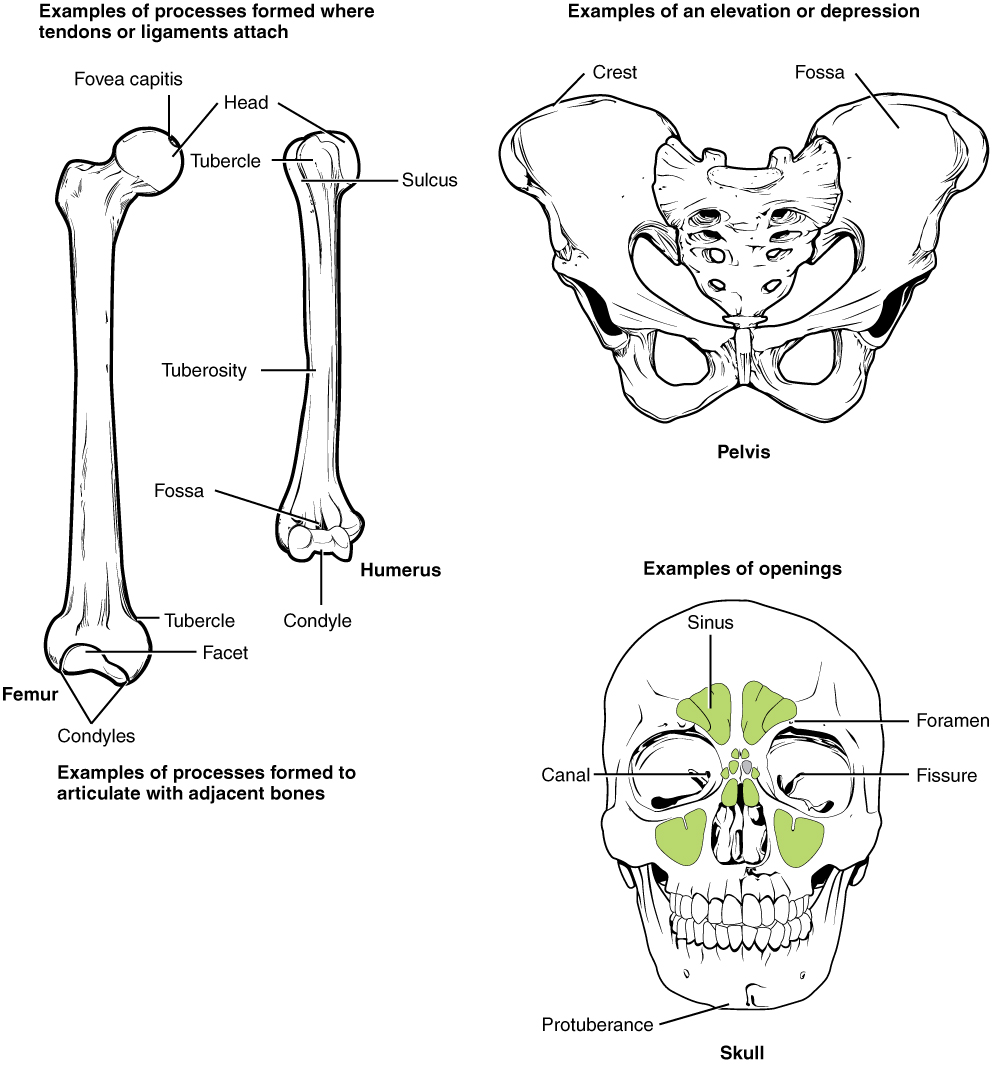 This illustration contains three diagrams. The left diagram is titled examples of processes formed where tendons or ligaments attach. The image shows an anterior view of the femur and an anterior view of the humerus. For the femur, the distal epiphysis contains a smaller lateral bulge and a larger medial bulge. These are examples of condyles. The inner halves of the two condyles as well as the groove between them compose a facet. An oval-shaped ridge on the medial surface of the distal metaphysis is an example of a tubercle. On the proximal epiphysis of the femur, the large knob that attaches to the hip socket is an example of a head. The tip of the head contains a small depression, an example of a fovea called the fovea capitis. On the humerus, the distal epiphysis contains a central depression that is an example of a fossa. Two condyles are located on the right and left sides of the fossa. The diaphysis of the humerus contains a small ridge running up the shaft that is an example of a tuberosity. The proximal epiphysis of the humerus contains a lateral and a medial bulge that are both examples of tubercles. Finally, a narrow groove runs from the center of the proximal metaphysis in between the medial and lateral condyles. This is an example of a sulcus. The middle image is entitled elevations or depressions. It shows an anterior view of the hip bones. The hip bones are shaped like two wings that join at the bottom. The crest along the upper edge of each hip bones, at the tip of each “wing” is an example of an elevation. A depression on the inner surface of both hip bones just under the crest is called out as a fossa. The right image is entitled examples of openings and shows an anterior view of the skull. The bone underlying the chin is an example of a protuberance while two small holes above each eye socket are examples of foramen. Five green sinuses surround the nose cavity are colored green. These are sinuses because they are hollowed out cavities within the skull bones. A small channel leads into the corner of each eye where the tear ducts occur. These two channels are both examples of a canal. Finally, the bones that form the posterior wall of the eye socket have a small crack running diagonally away from the nose. These are examples of fissures.