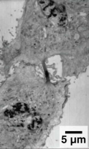 A micrograph of a plant cell undergoing cytokinesis. The two daughter cells can clearly be seen dividing.