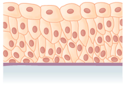 many layers of irregularly shaped cells with diverse sizes