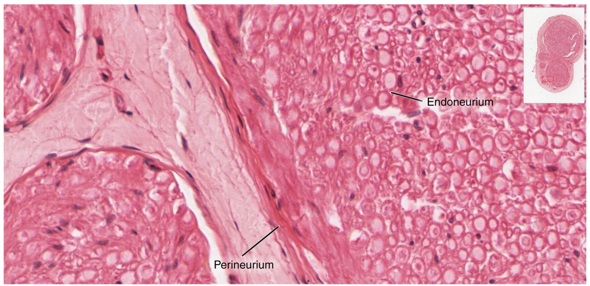 This micrograph shows a magnified view of the nerve. The perineurium and the endoneurium are labeled.