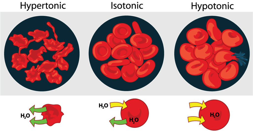 The left part of this illustration shows shriveled red blood cells bathed in a hypertonic solution. The middle part shows healthy red blood cells bathed in an isotonic solution, and the right part shows bloated red blood cells bathed in a hypotonic solution. One of the bloated cells in the hypotonic solution bursts.