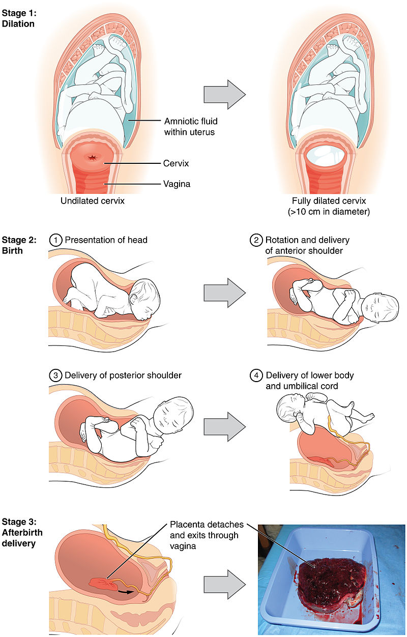 Diagram showing the three stages of childbirth: dilation, birth, and the afterbirth delivery.