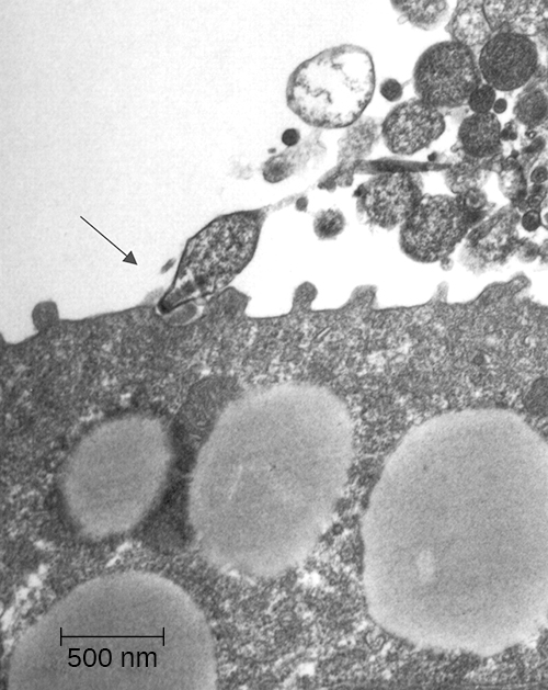 The micrograph shows Mycoplasma pneumoniae using their specialized receptors to attach to epithelial cells in the trachea of an infected hamster. (credit: modification of work by American Society for Microbiology)
