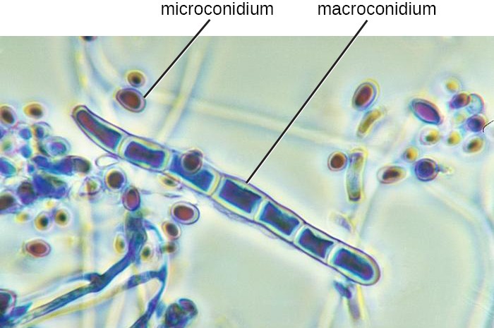 A micrograph of a long strands with cell walls. The long strand is labeled macroconidium. Smaller spheres outside the long strand are labeled microconidia.
