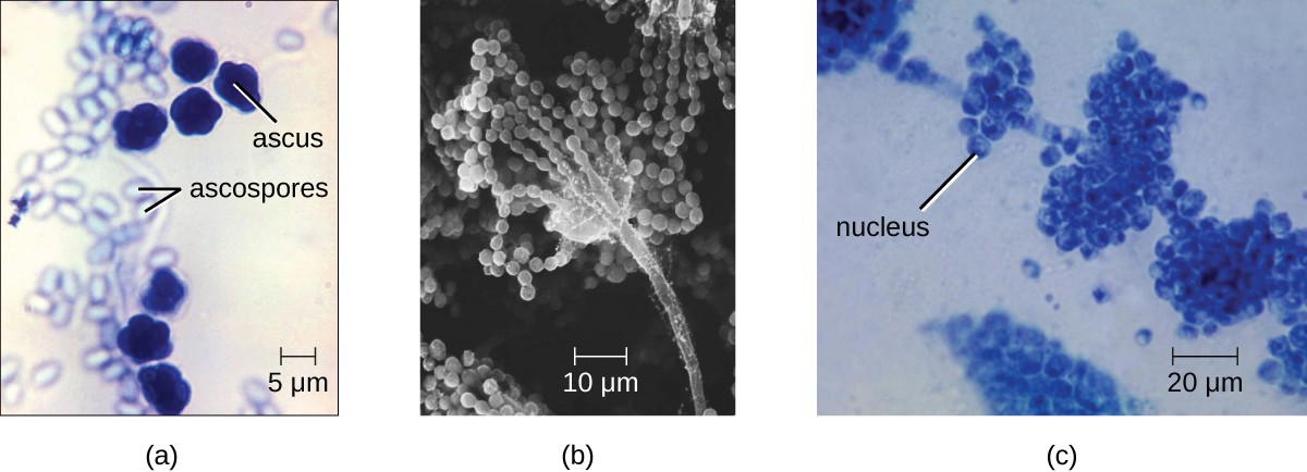 a) a micrograph of a large oval (10 µm) labeled ascus and smaller ovals (5 µm) labeled ascospores. B) a micrograph of a long stalk with strands of spheres emanating from a sphere on the tip. The spheres are about 2 µm in diameter. C) A long strand with clusters of spheres. A small dot in each sphere is labeled nucleus.