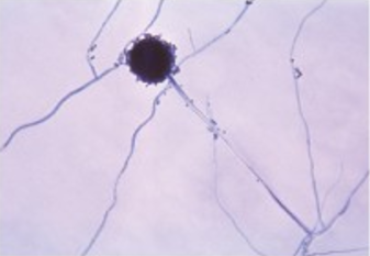 An image of Aspergillus niger shows long strands with a dark sphere at the end of one strand. 