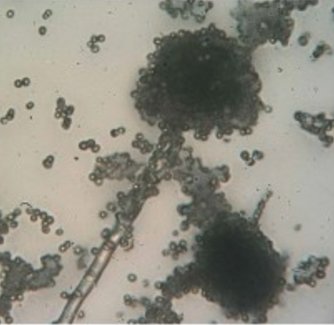 A micrograph shows a long strand with many small dots everywhere on the slide.