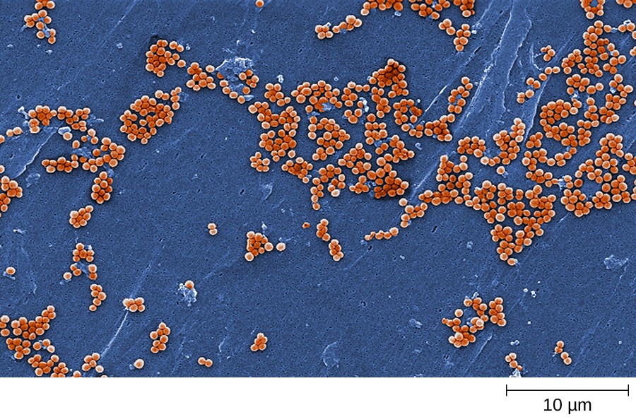 A micrograph showing clusters of spherical cells.