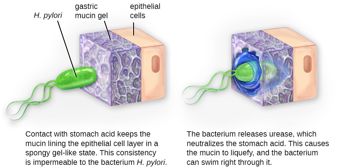 Diagram of H. pylori invading the lining of the stomach. In the first image the H. pylori (an oval cell with 3 flagella is not able to penetrate the gastric mucin gel on top of the epithelial cells. Contact with stomach acid keeps the mucin lining the epithelial cell layer in a spongy gel-like state. This consistency is impermeable to the bacterium H. pylori. The second image shows the bacterium entering the lining. The bacterium releases urease, which neutralizes the stomach acid. This causes the mucin to liquefy and the bacterium can swim right through it.