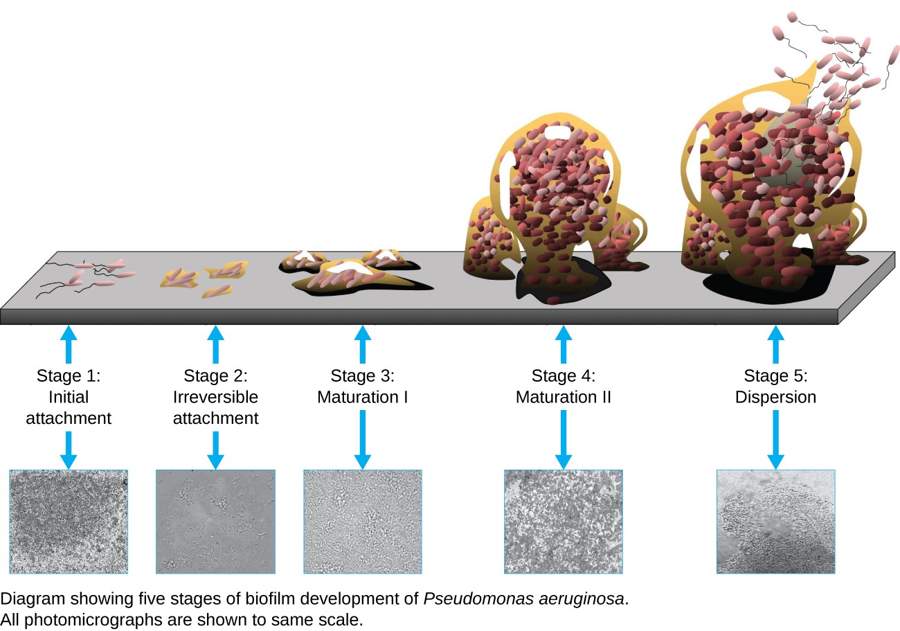 The stages of a biofilm are shown. In stage 1 (initial attachment), a few flagellated cells attach to a surface. In stage 2 (irreversible attachment) clumps of cells are found on the surface. In stage 3 (maturation) the clumps have enlarged. In stage 4 (maturation 2) the clumps have fused and enlarged greatly. In stage 5 (dispersal) the large clump releases flagellated cells away from the surface. These stages are also shown in micrographs: 1) small dots, 2) larger clumps, 3)larger clump, 4) a large mass, 5) a large mass with an opening at the top.