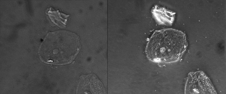 Two micrographs of a cell on a dark background are shown. In the brightfield image the cell is a faint circle with a small grey circle in the center. In the phase-contrast image the cell is a bright circle with a bright circle in the center.