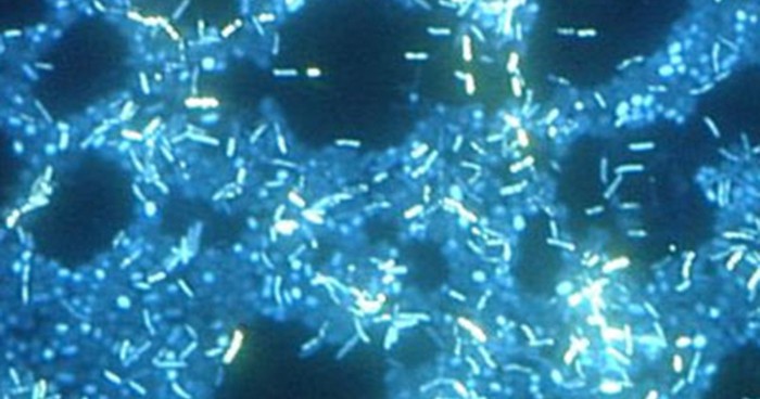 A micrograph with a black background containing many bright rectangles in clumps is shown.