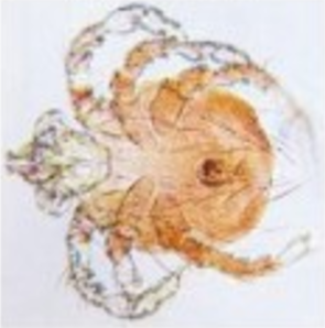 A micrograph of a mite
