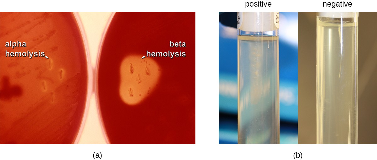 a) Two blood agar plates which have a red color. The left plate is labeled alpha hemolysis and shows slight clearings around the colonies. The right plate is labeled beta hemolysis and shows complete clearings around the colonies. B) Two tubes. The left tube is positive and shows cloudiness spreading out from the central line down the middle of the tube. The right tube is negative and shows no cloudiness spreading out from this central line.