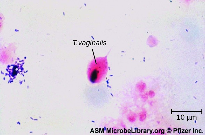 Micrograph of small purple cells and larger oval cells.