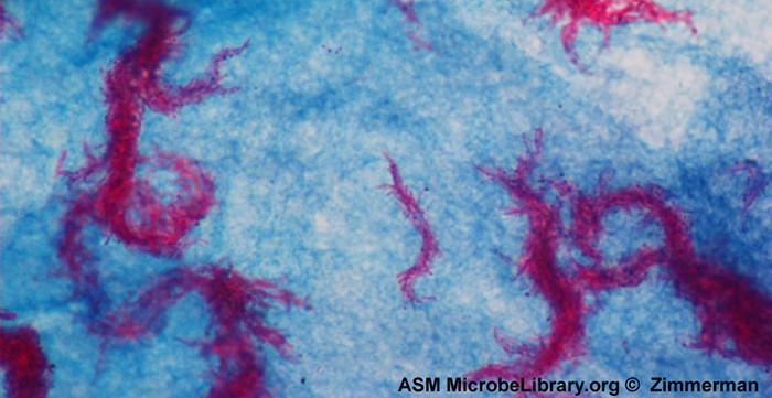 A micrograph shows red chains of cells on a blue background.