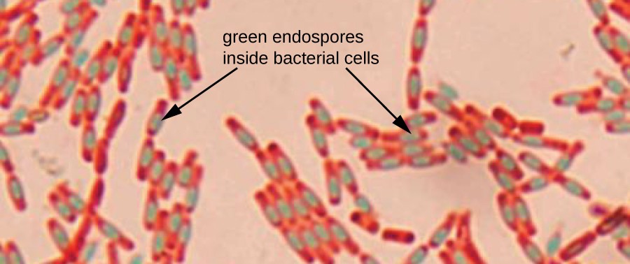 A micrograph shows chains of red rods. Each red rod contains a green oval. An arrow pointing to the green ovals states: green endospore inside bacterial cells.