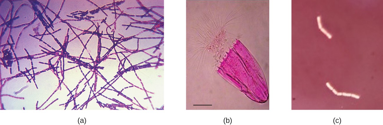 Micrograph a shows chains of purple rectangles on a clear background. Micrograph B shows a purple cell on a clear background; the cell looks like a jelly with an umbrella top and long projections. Micrograph C shows clear chains of rectangles on a dark background.