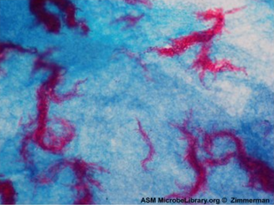 Acid-fast bacteria are red; non-acid-fast cells are blue.