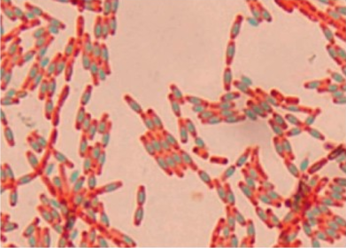 Endospores appear bluish-green; other structures appear pink to red