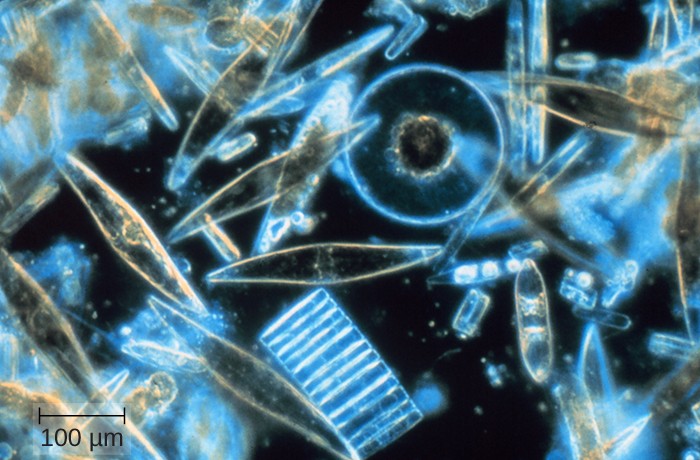 A light micrograph with a black background and glowing cells. The cells have many different shapes ranging from circular to stacks of rectangles to almond shaped. A scale bar indicates how much space 100 microns takes up in this figure.
