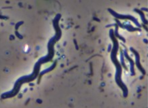 micrograph of cork screws-shaped cells