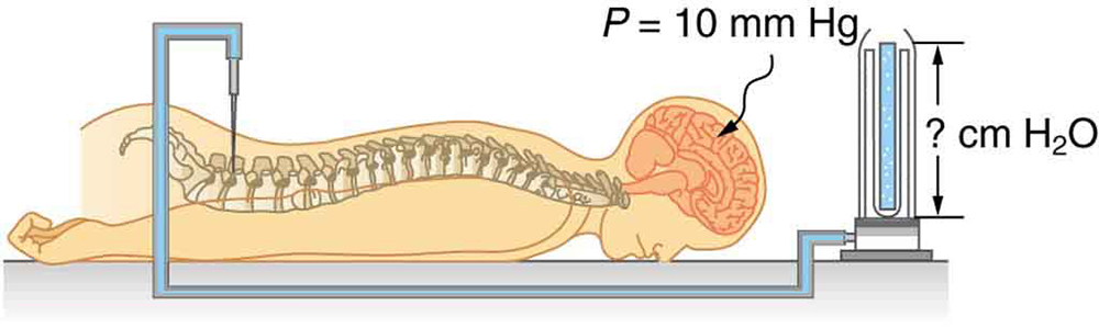 how to measure pressure of human body