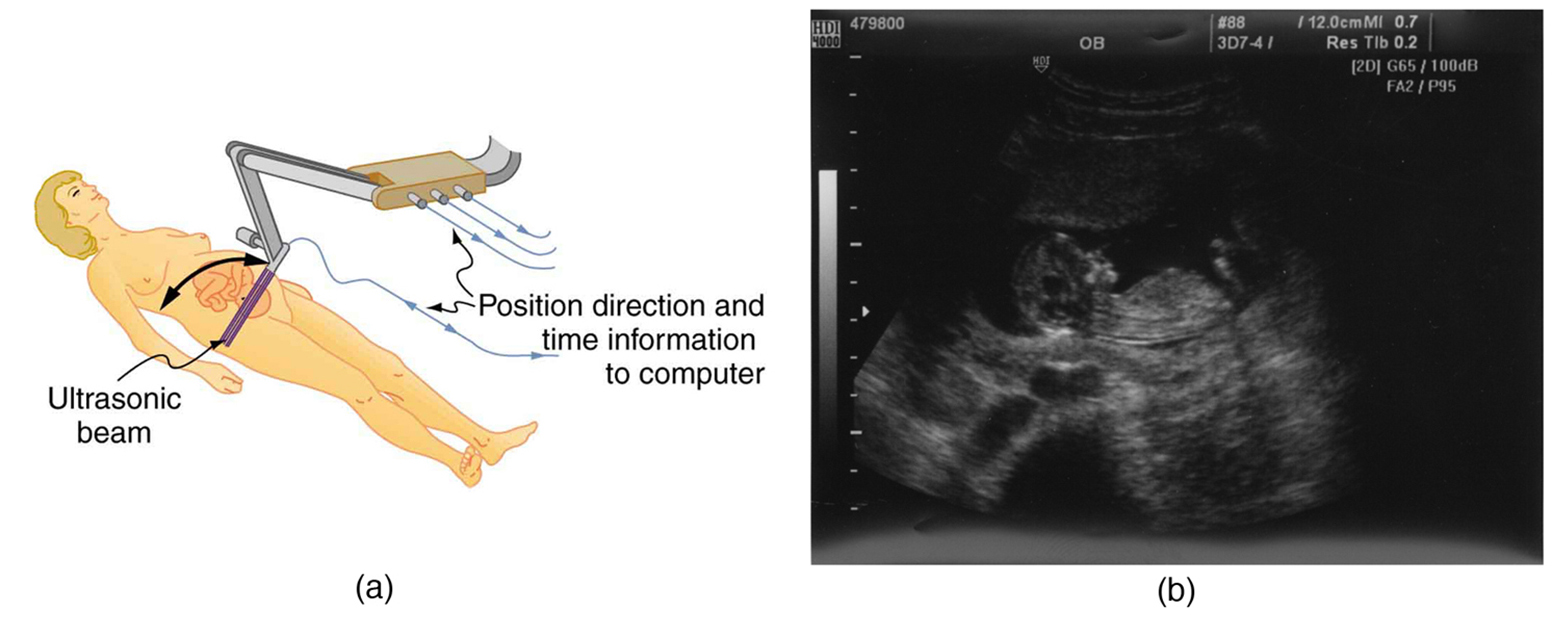 The first part of the diagram shows an ultrasound device scanning a woman’s abdomen. The second part of the diagram is an ultrasound scan report of the abdomen.