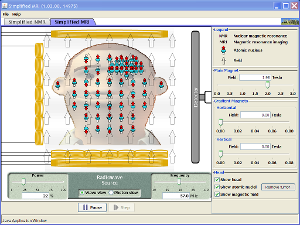 Simplified MRI screenshot.