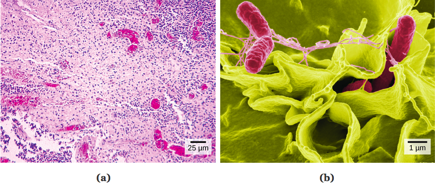 Part a: Salmonella through a light microscope appear as tiny purple dots. Part b: In this scanning electron micrograph, bacteria appear as three-dimensional ovals. The human cells are much larger with a complex, folded appearance. Some of the bacteria lie on the surface of the human cells, and some are squeezed between them.
