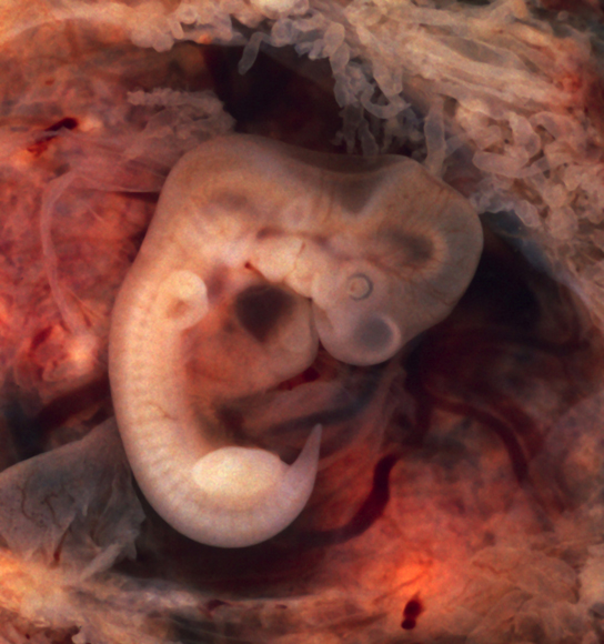  Embryo resembles a segmented earthworm with a bulging head.